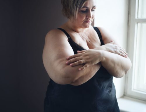 L’obésité au Pôle de santé du Villeneuvois : un poids partagé